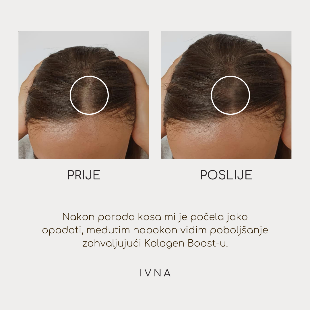 Prije i poslije